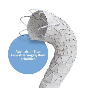 Ankura™ TAA Stent Graft System